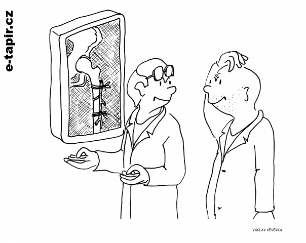 rentgen kost-00c4b161