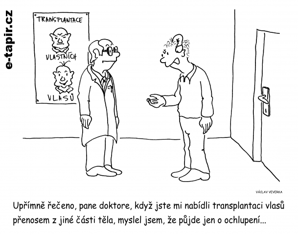 Transplantace vlasů-7eb53a51